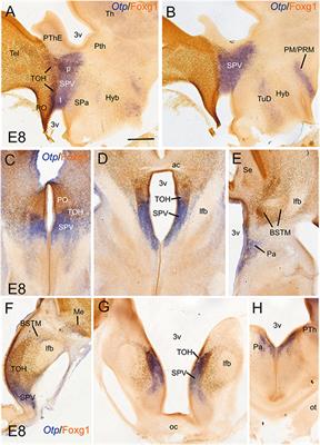 Distinct Subdivisions in the Transition Between Telencephalon and Hypothalamus Produce Otp and Sim1 Cells for the Extended Amygdala in Sauropsids